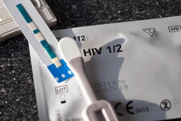 آشنایی با روش های تشخیص آزمایشگاهی بیماری ایدز